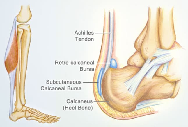アキレス腱と滑液包の解剖図