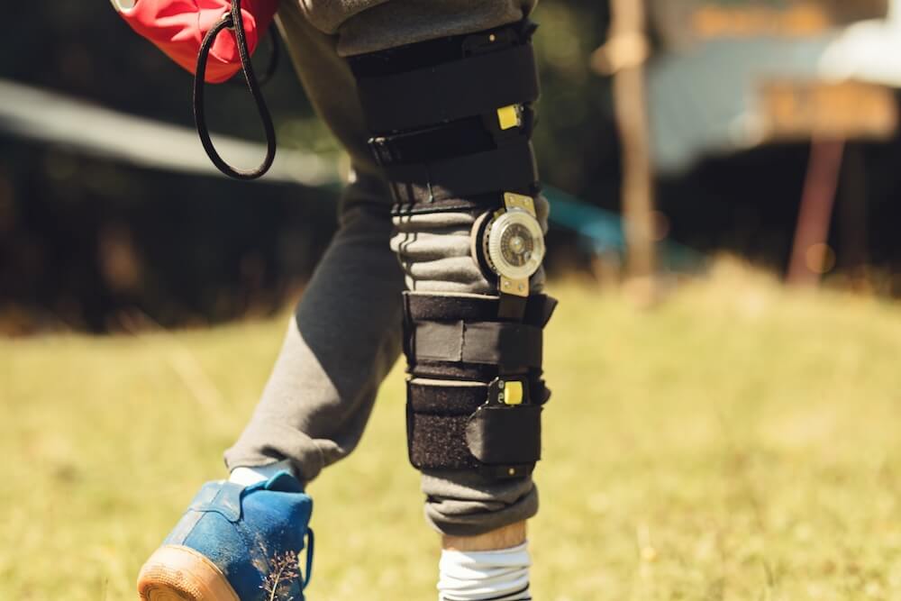 a person who injured his/her knee is wearing brace to protect the knee